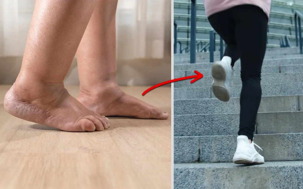 before and after using Akusoli insoles