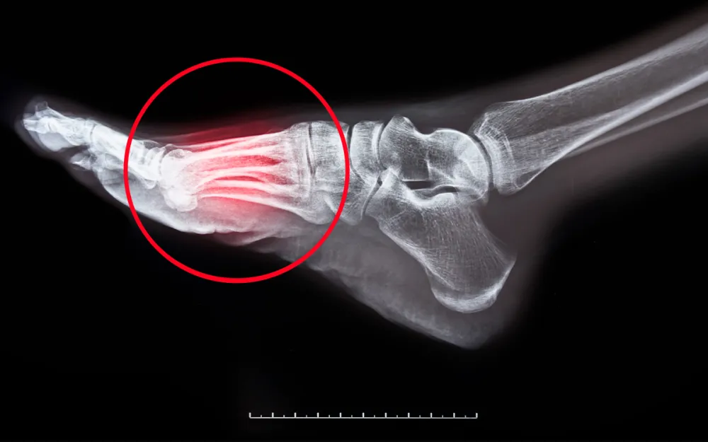 close up of foot pain