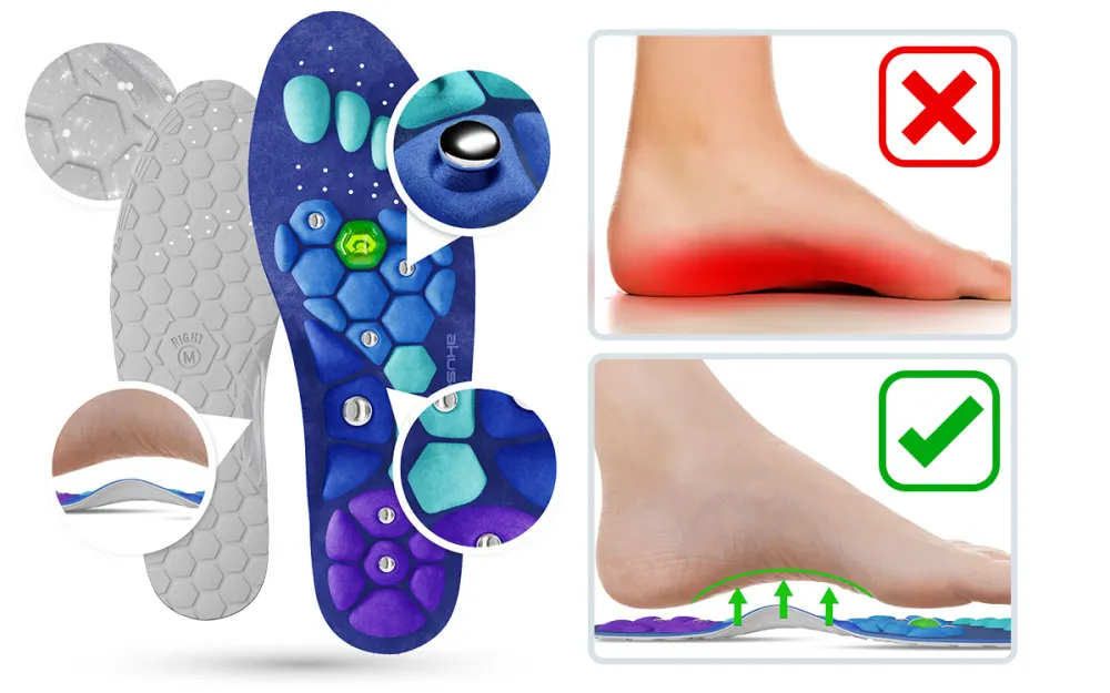 Akusoli insoles helping the right form of the feet